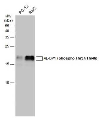 Western Blot: 4EBP1 [p Thr46, p Thr37] Antibody [NBP3-13169]